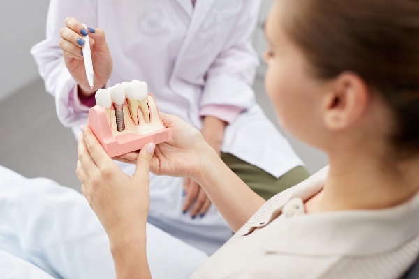 Implante dental en Recoleta