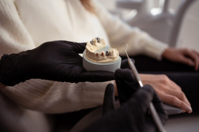 Precio de un implante dental unitario en CABA: factores que influyen, rangos orientativos y opciones de pago